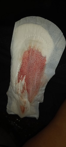MISCARRIAGE OR/ PERIOD????