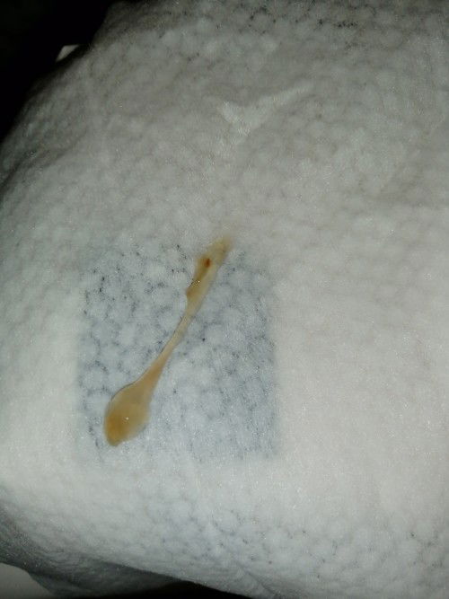 Kandungan 38 minggu 6 hari