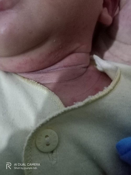 Biang keringat bukan??