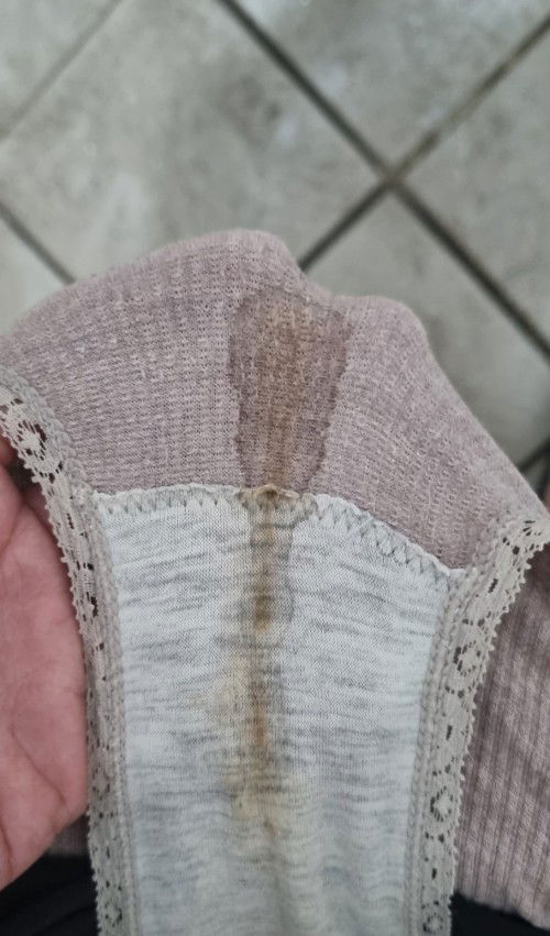 Flek atau bukan ya ?