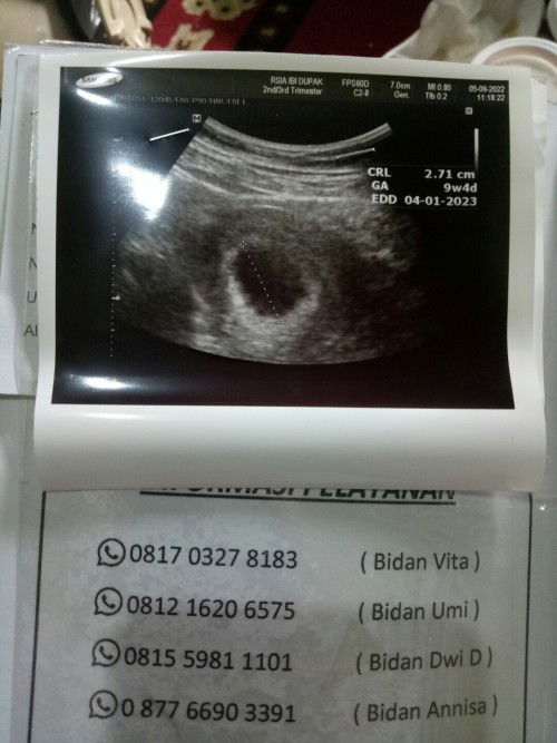 Flek di usia 6 minggu