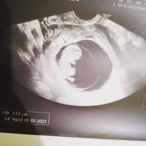 NEEDS ADVICE AND INSIGHTS 😔