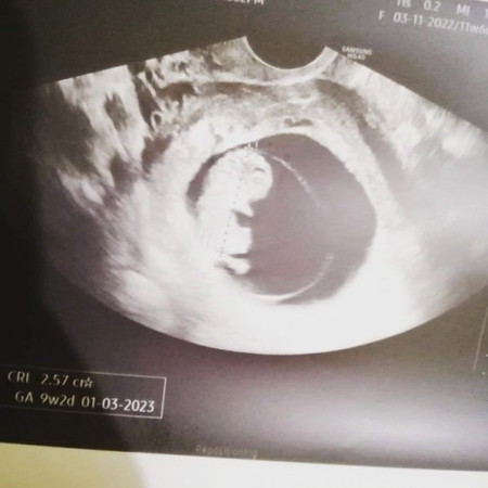 NEEDS ADVICE AND INSIGHTS 😔