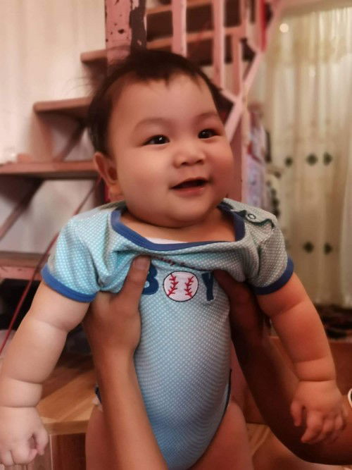 Falling hair of my 6 months old baby