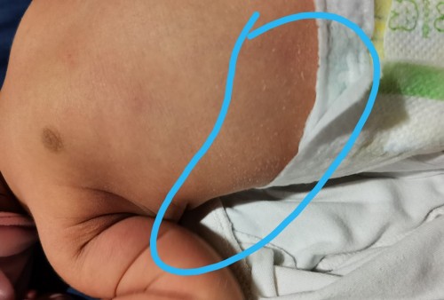 Dry skin for new born