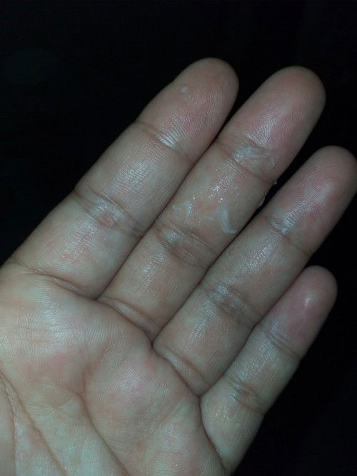 33week 5d มีมูกใสไหลออกมาแต่ไม่เยอะ ปกติเป็นหมาดขาวจะไม่มีมูกใสปนออกมาแต่วันนี้มีมูกใสไหลออกมาด้วย