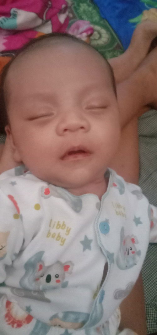 Bayi baru lahir ber ingus