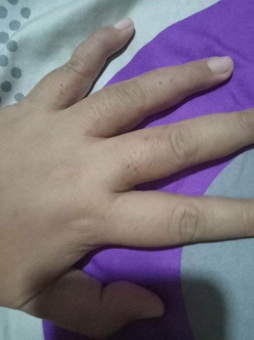 Badan pada gatel- gatel