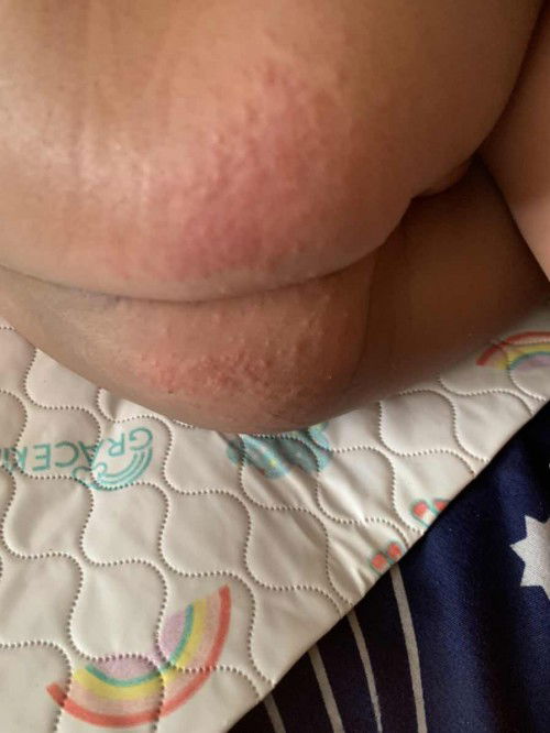 สอบถามแม่ๆหน่อยค่ะ