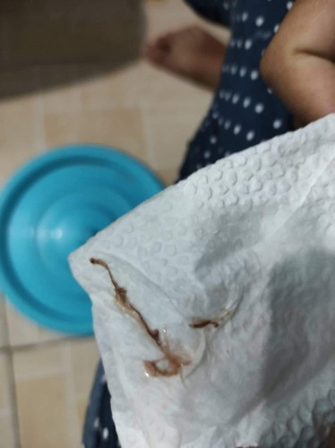 Light Bleeding to Brown Discharge