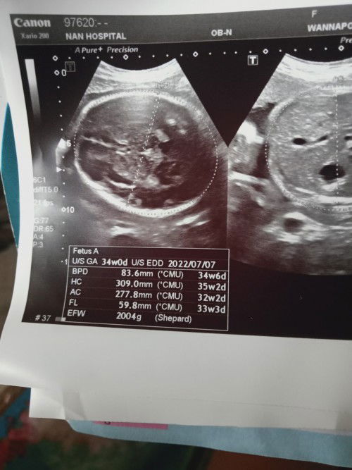 ขอตั้งคำถามที่2 ต่อนะคะ