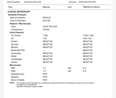 Urinalysis result