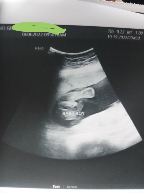 21 weeks potoytoy is real.
.