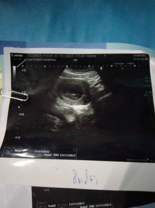 แม่ๆเจอน้องกันตอนกี่วิคค่ะ☺️