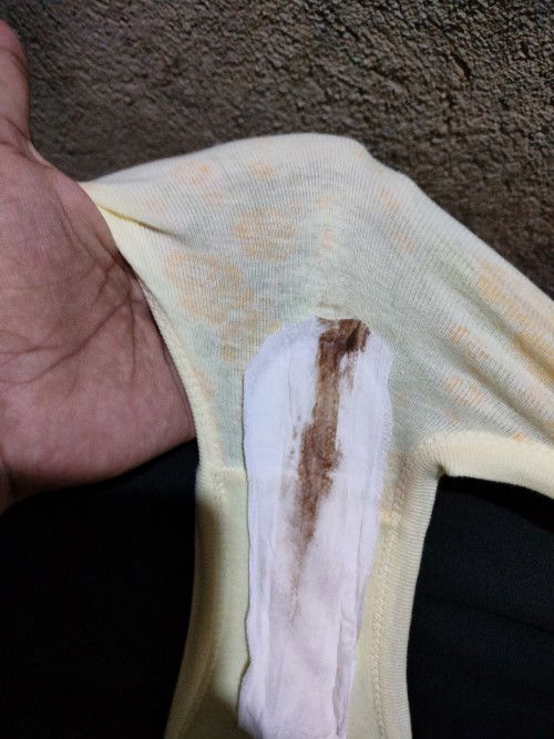 Start na po ng labor ??