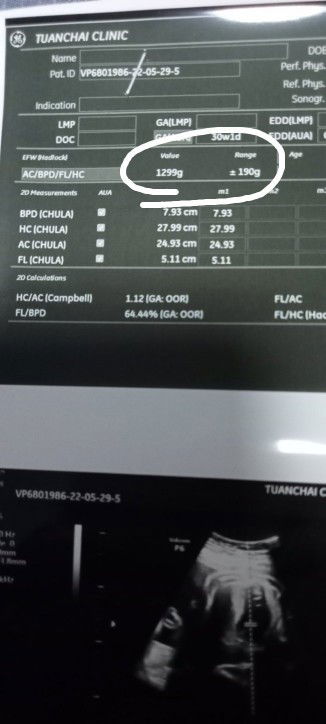 น้ำหนักในใบอันตร้าซาว