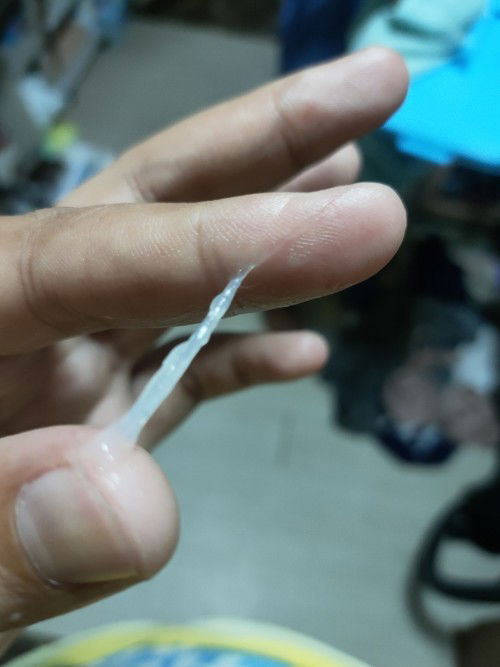 มูกใสแบบนี้ปกติไหมคะ