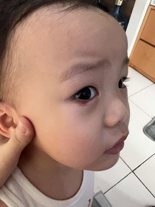 Sudah 3 bulan ga sembuh-sembuh