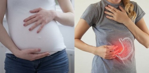 Dada Seperti Terbakar Saat Hamil? Begini Cara Mengatasi Heartburn