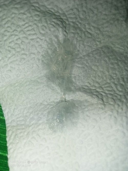 ท้องแรกค่ะขอสอบถามแม่ๆที่มีประสบการณ์หน่อยค่ะ