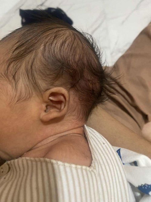 Baby leher bawah pipi besar sebelah