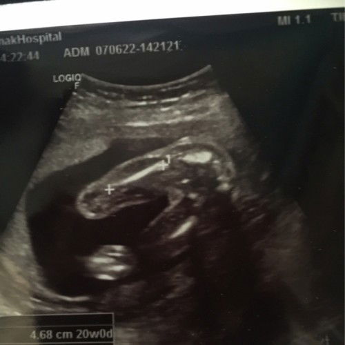 เเชร์ประสบการณ์