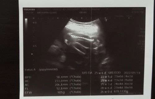 #ทีมกันยายน 65 #ยังไม่ทราบเพศแน่ชัด