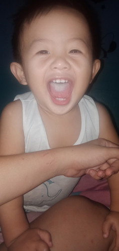 puti sa dila ni baby