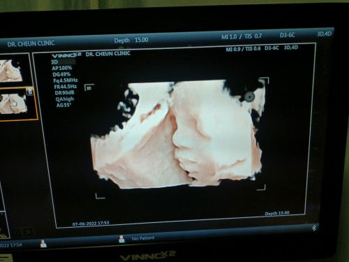 น้ำหนักน้องเกินเกณฑ์มาเกือบ2อาทิตย์