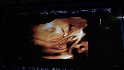 ทีมเดือนสิงหาคม