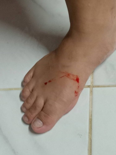 ท้อง6เดือนกว่ามีเลือดออก