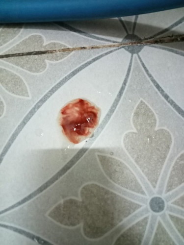 ตั้งครรภ์ได้ 38 w 5d