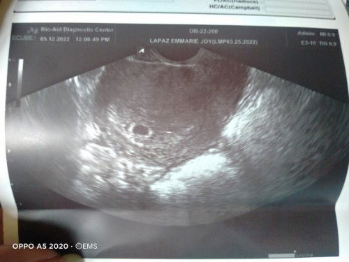 Praning about Blighted Ovum Case.