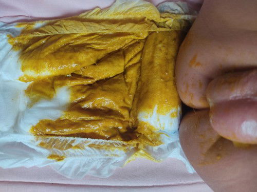 s26 pink milk ni bby normal lng po kaya na basa ung tae nya? evry 2-3dys sya natae pro mdami na basa