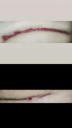 Riwayat sc 2tahun