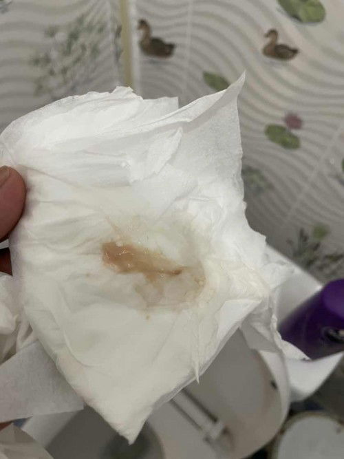 โดนกระตุ้นปากมดลูก 39+3