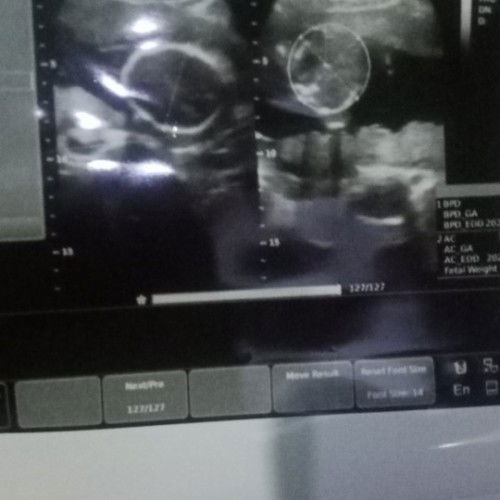 Cara mengetahui hasil gambar usg