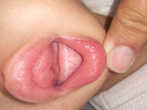 14 bulan belum tumbuh gigi, khawatir banget.