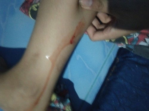 แบบนี้เสี่ยงแท้งไหมค่ะ