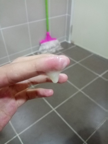 แบบนี้มูกใสหรือตกขาว
