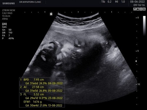 ทำไมดูหน้าลูกแปลกๆไม่กล้าถามหมอหรือในภาพซาวเป็นแบบนี้คะขอดูรูปลูกๆบ้านอื่นหน่อยค่ะ