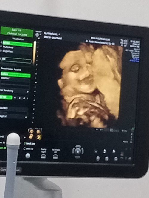 Yg HPLnya bulan september 2022