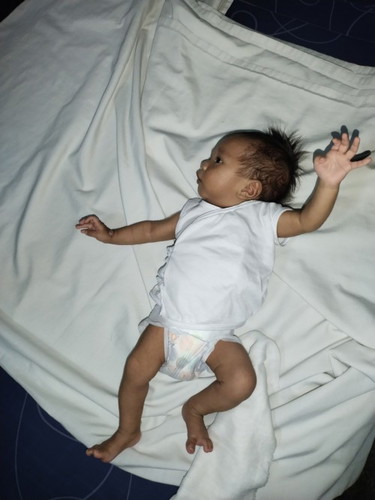 normal po bang nakatingin si baby sa gilid nag woworry po kasi ako .thanks po