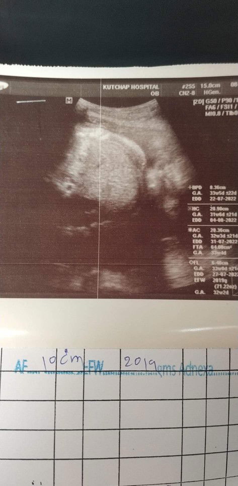 ช่วยดูให้หน่อย