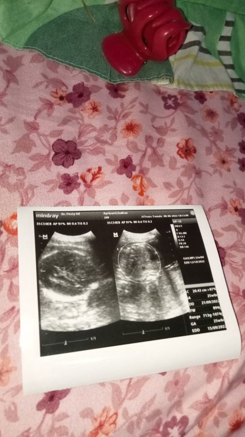 Minta doanya bunda2