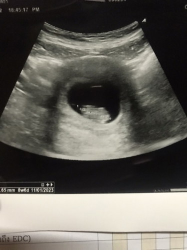 9 สัปดาห์แล้ว