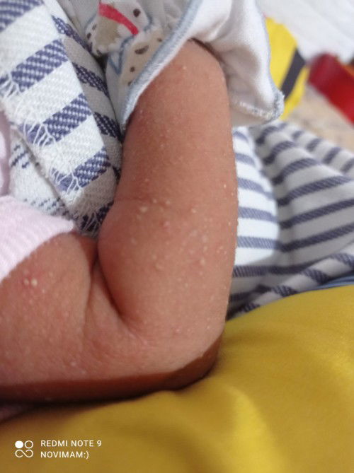 Biang keringat atau bukan ya