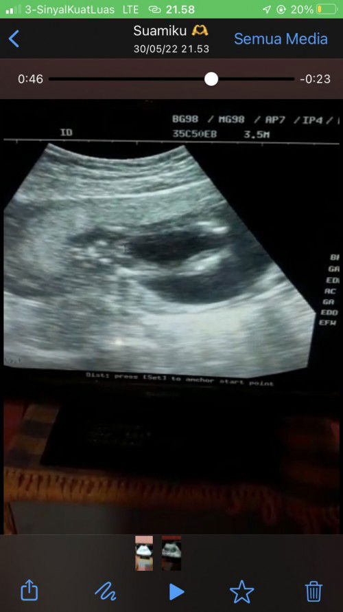 Ada yang tau jenis kelamin ini ?