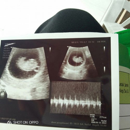 Mau sharing sedikit dong bund