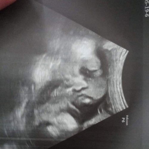 ทีมมิถุนาไม่ยอมออกเลยจ้า55